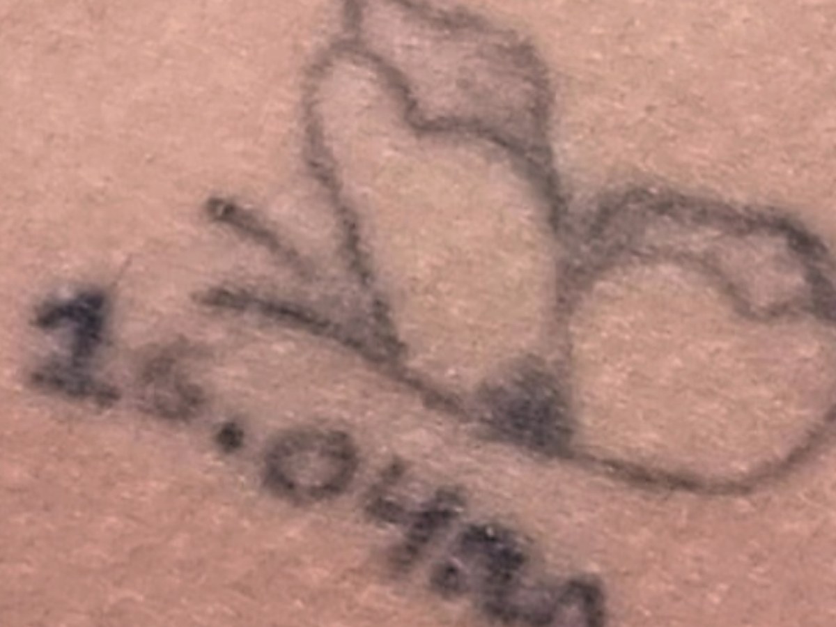Antes: Eliminación de tatuajes · 2 sesiones