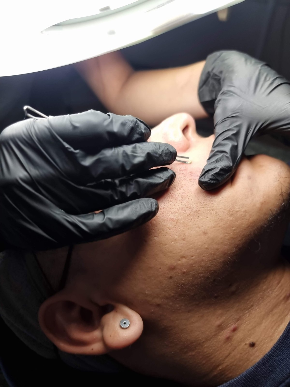 Limpieza facial profunda