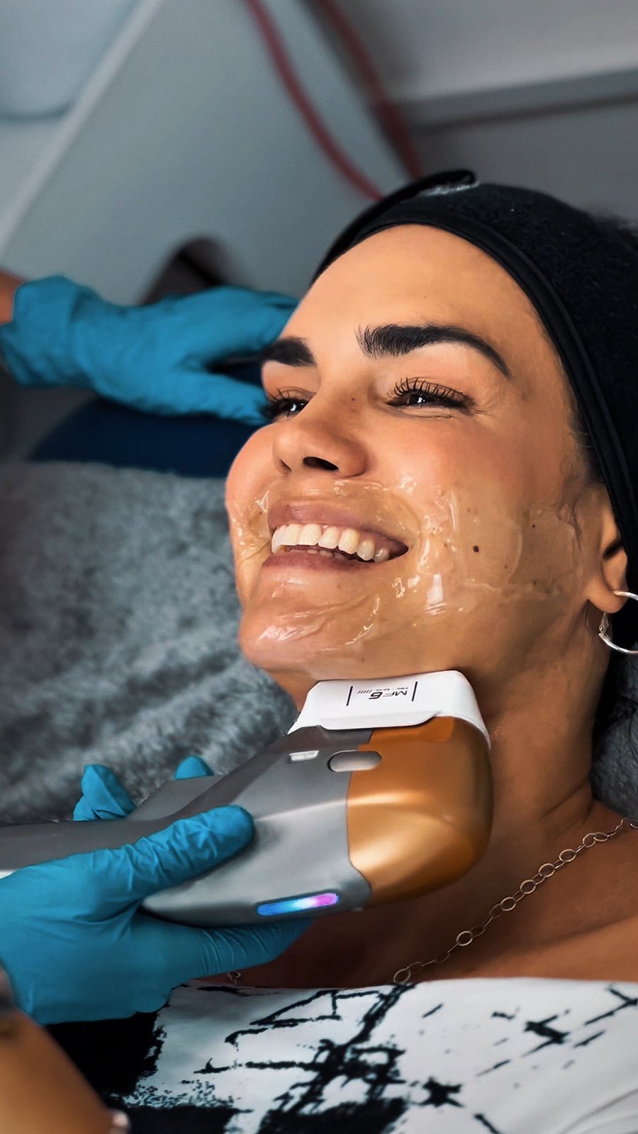 HIFU facial (por zona)