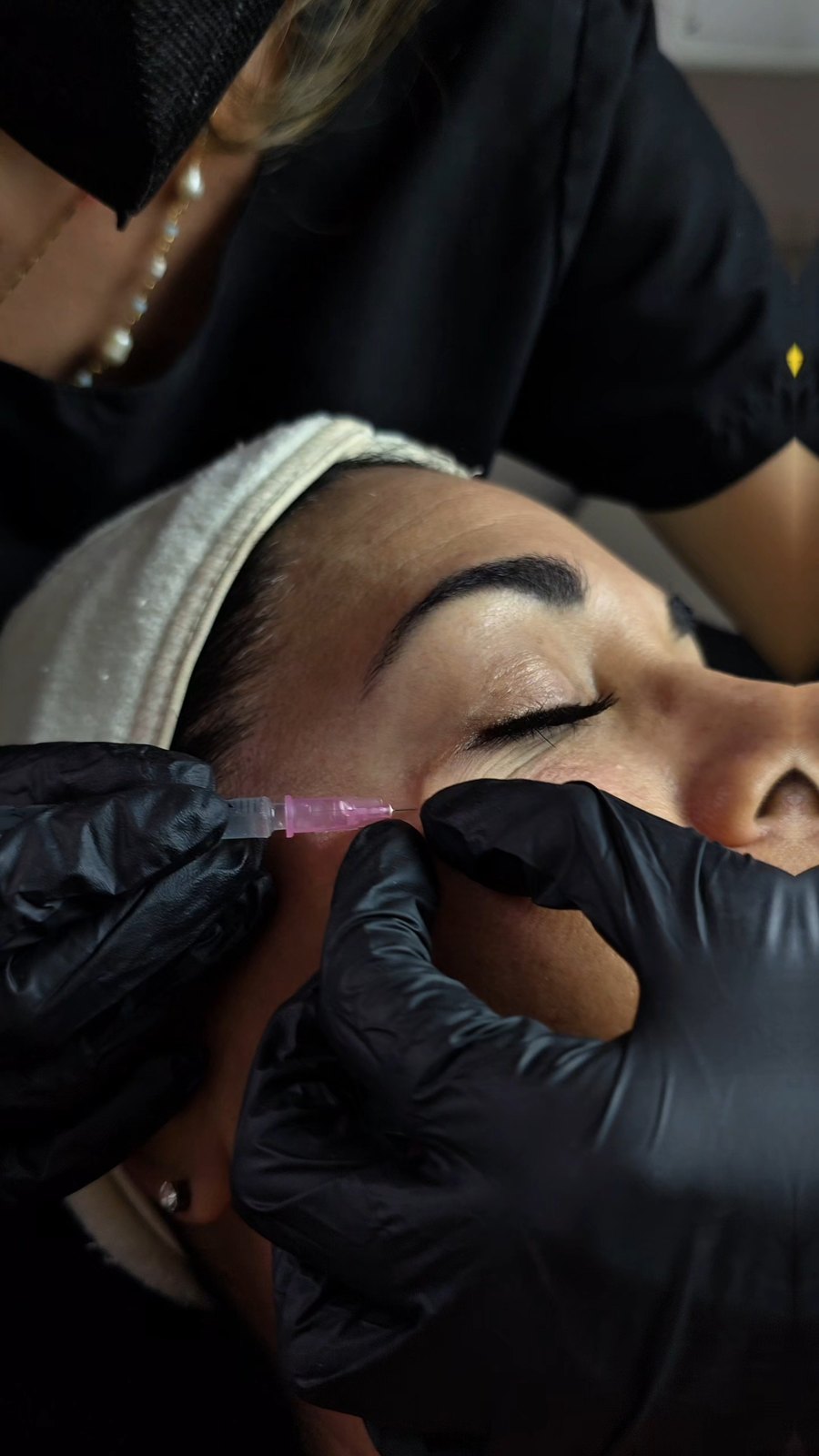 Fibroblast por zona